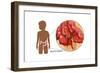 Ruptured Appendix-Monica Schroeder-Framed Art Print