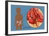 Ruptured Appendix-Monica Schroeder-Framed Giclee Print