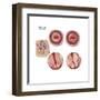 Sagittal View and Vaginal View of Advanced Cervical Cancer-null-Framed Art Print