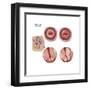 Sagittal View and Vaginal View of Advanced Cervical Cancer-null-Framed Art Print