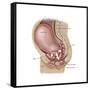 Sagittal View of Pregnant Uterus Showing Displaced Pelvic Organs-null-Framed Stretched Canvas