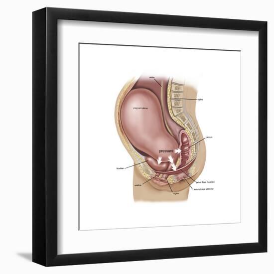 Sagittal View of Pregnant Uterus Showing Displaced Pelvic Organs-null-Framed Art Print