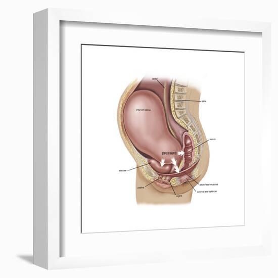 Sagittal View of Pregnant Uterus Showing Displaced Pelvic Organs-null-Framed Art Print