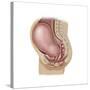 Sagittal View of Pregnant Uterus Showing Displaced Pelvic Organs-null-Stretched Canvas