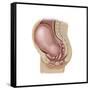 Sagittal View of Pregnant Uterus Showing Displaced Pelvic Organs-null-Framed Stretched Canvas