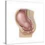Sagittal View of Pregnant Uterus Showing Displaced Pelvic Organs-null-Stretched Canvas