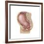 Sagittal View of Pregnant Uterus Showing Displaced Pelvic Organs-null-Framed Art Print