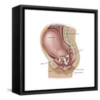 Sagittal View of Pregnant Uterus Showing Displaced Pelvic Organs-null-Framed Stretched Canvas