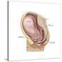 Sagittal View of Pregnant Uterus Showing Outline of Usual Position of Pelvic Organs-null-Stretched Canvas