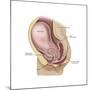 Sagittal View of Pregnant Uterus Showing Outline of Usual Position of Pelvic Organs-null-Mounted Art Print