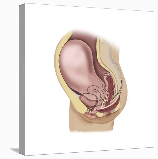 Sagittal View of Pregnant Uterus Showing Outline of Usual Position of Pelvic Organs-null-Stretched Canvas