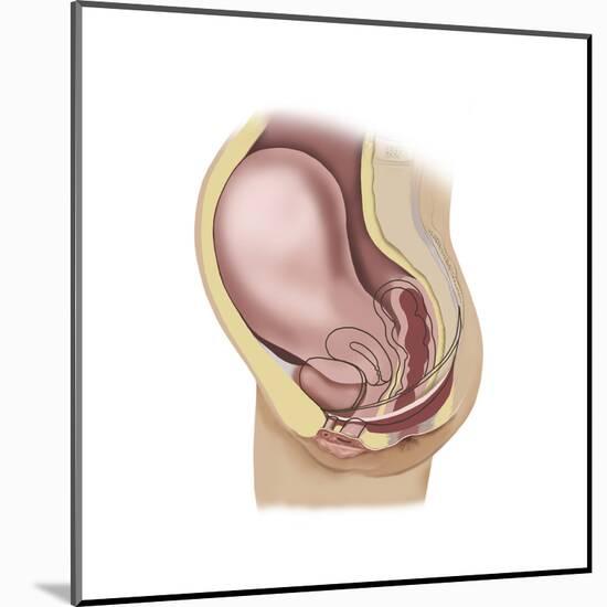 Sagittal View of Pregnant Uterus Showing Outline of Usual Position of Pelvic Organs-null-Mounted Art Print