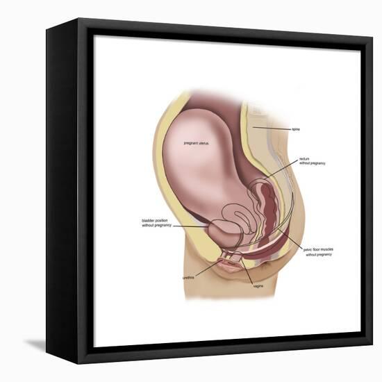 Sagittal View of Pregnant Uterus Showing Outline of Usual Position of Pelvic Organs-null-Framed Stretched Canvas