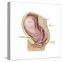 Sagittal View of Pregnant Uterus Showing Outline of Usual Position of Pelvic Organs-null-Stretched Canvas