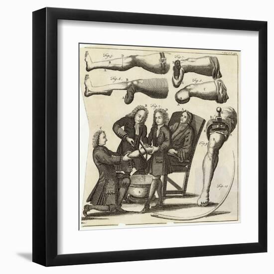 Sawing off a Leg-Heister-Framed Art Print