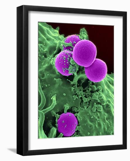 Scanning Electron Micrograph of a Human Neutrophil Ingesting Mrsa-Stocktrek Images-Framed Photographic Print