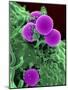 Scanning Electron Micrograph of a Human Neutrophil Ingesting Mrsa-Stocktrek Images-Mounted Photographic Print