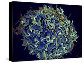 Scanning Electron Micrograph of Hiv Particles Infecting a Human H9 T Cell-Stocktrek Images-Stretched Canvas