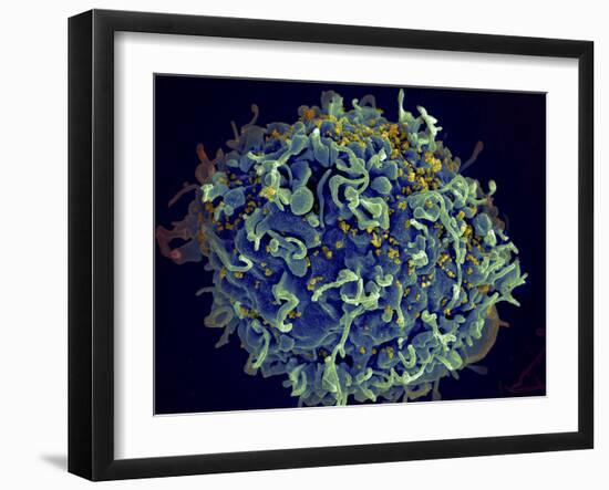 Scanning Electron Micrograph of Hiv Particles Infecting a Human H9 T Cell-Stocktrek Images-Framed Photographic Print