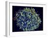 Scanning Electron Micrograph of Hiv Particles Infecting a Human H9 T Cell-Stocktrek Images-Framed Photographic Print