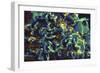 Scanning Electron Micrograph of Hiv Particles Infecting a Human T Cell-Stocktrek Images-Framed Photographic Print
