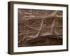 Scanning Electron Micrograph (Sem): Mycorrhiza-null-Framed Photographic Print