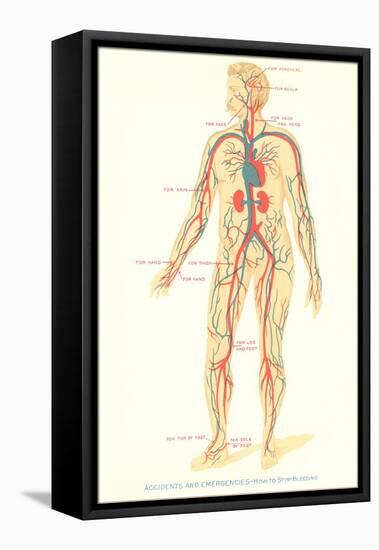 Schematic of Circulatory System-null-Framed Stretched Canvas