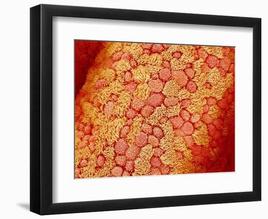 Section of Pleat on Interior of Oviduct of Rabbit-Micro Discovery-Framed Photographic Print