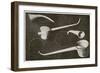 Selection of Beethoven's Hearing Aids-null-Framed Art Print