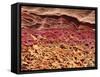 SEM of Section Through Human Skin-Steve Gschmeissner-Framed Stretched Canvas