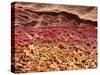 SEM of Section Through Human Skin-Steve Gschmeissner-Stretched Canvas