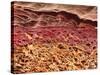 SEM of Section Through Human Skin-Steve Gschmeissner-Stretched Canvas