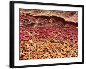 SEM of Section Through Human Skin-Steve Gschmeissner-Framed Photographic Print