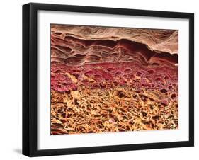 SEM of Section Through Human Skin-Steve Gschmeissner-Framed Photographic Print