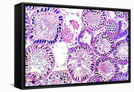 Seminiferous Tubules-Dr. Keith Wheeler-Framed Stretched Canvas