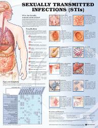 affordable medical charts posters for sale at allposters com