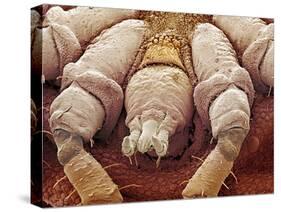 Sheep Tick, SEM-Steve Gschmeissner-Stretched Canvas