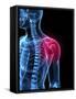 Shoulder Pain, Conceptual Artwork-SCIEPRO-Framed Stretched Canvas