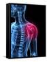 Shoulder Pain, Conceptual Artwork-SCIEPRO-Framed Stretched Canvas