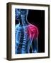 Shoulder Pain, Conceptual Artwork-SCIEPRO-Framed Photographic Print