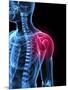 Shoulder Pain, Conceptual Artwork-SCIEPRO-Mounted Photographic Print