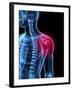 Shoulder Pain, Conceptual Artwork-SCIEPRO-Framed Photographic Print