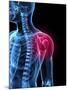 Shoulder Pain, Conceptual Artwork-SCIEPRO-Mounted Photographic Print