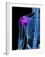 Shoulder Pain, Conceptual Artwork-SCIEPRO-Framed Photographic Print