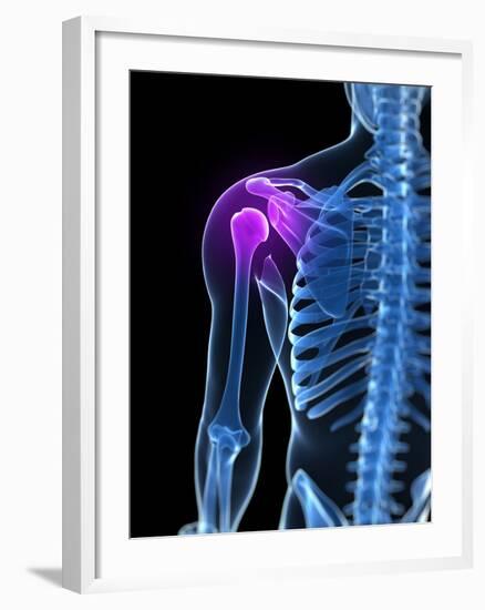 Shoulder Pain, Conceptual Artwork-SCIEPRO-Framed Photographic Print