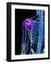Shoulder Pain, Conceptual Artwork-SCIEPRO-Framed Photographic Print