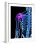 Shoulder Pain, Conceptual Artwork-SCIEPRO-Framed Photographic Print