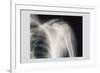 Shoulder-null-Framed Art Print