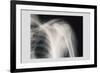 Shoulder-null-Framed Art Print