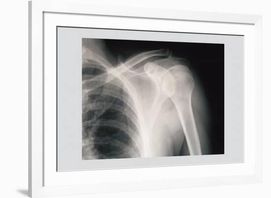 Shoulder-null-Framed Premium Giclee Print